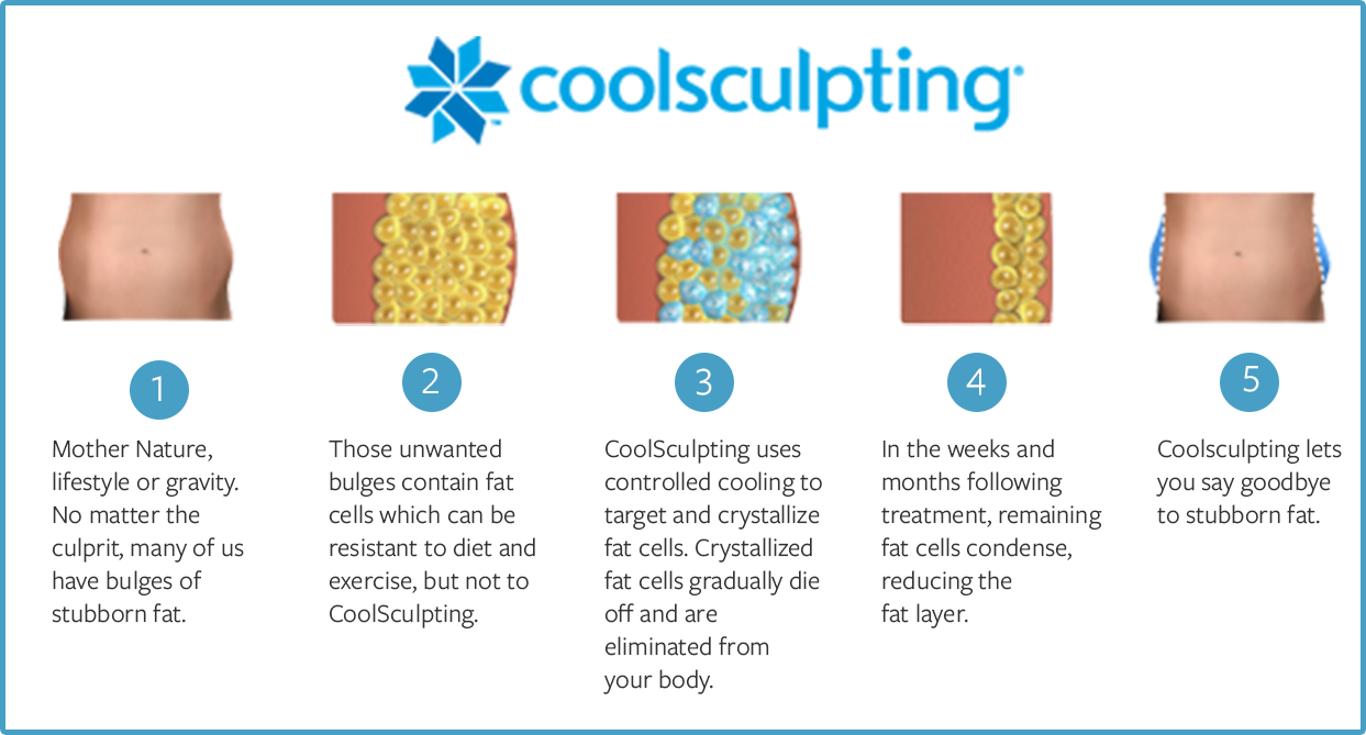 CoolSculpting process