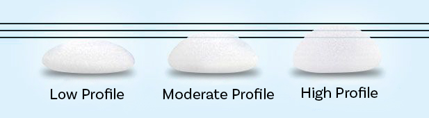 Breast implant profiles