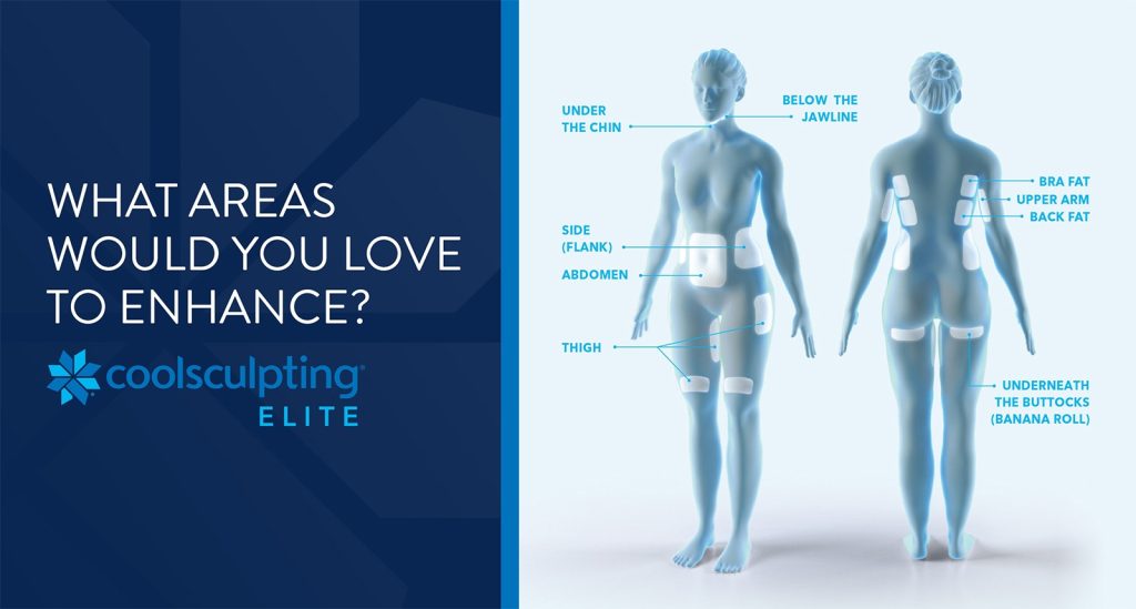 Diagram of areas to enhance with coolscupting elite