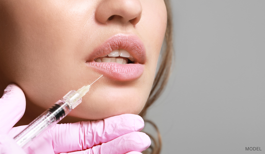 Woman receiving lip filler injections (model)
