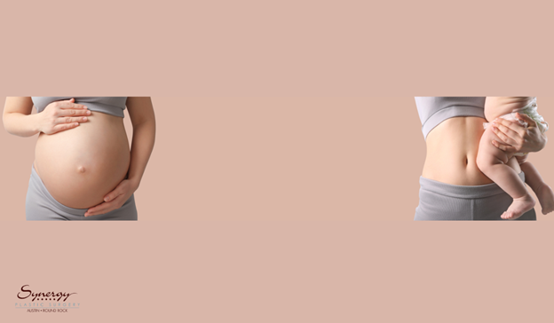 The Top Non-Surgical Treatments for Postpartum Body Changes – Synergy  Plastic Surgery